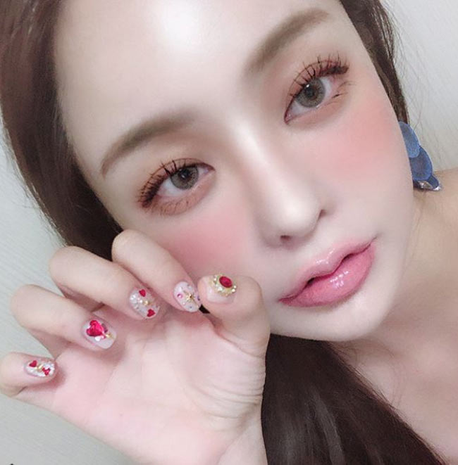Mặc dù nghe có vẻ đơn giản nhưng phẫu thuật cắt tạo hình môi rất đau đớn.
