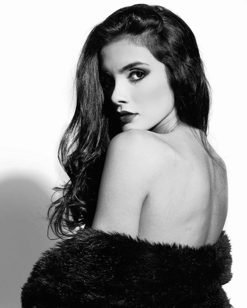 Nhan sắc tựa nữ thần Hy Lạp của "Hoa hậu ngất xỉu" - 13