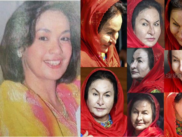 Làm đẹp - Gương mặt phu nhân cựu Thủ tướng Malaysia biến dạng gây sững sờ