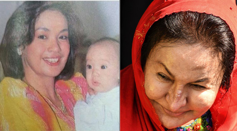 Gương mặt phu nhân cựu Thủ tướng Malaysia biến dạng gây sững sờ - 1