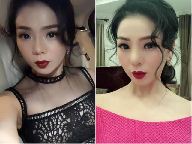 Ca nhạc - MTV - Gương mặt khác lạ của Lệ Quyên sau biến chứng vì "dao kéo"