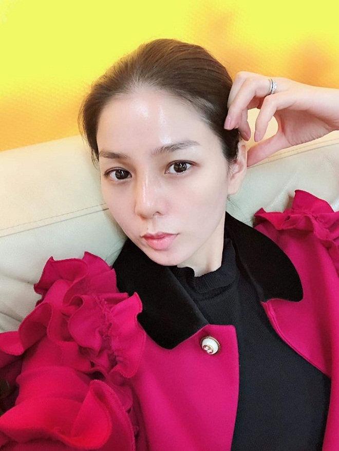 Gương mặt khác lạ của Lệ Quyên sau biến chứng vì "dao kéo" - 1