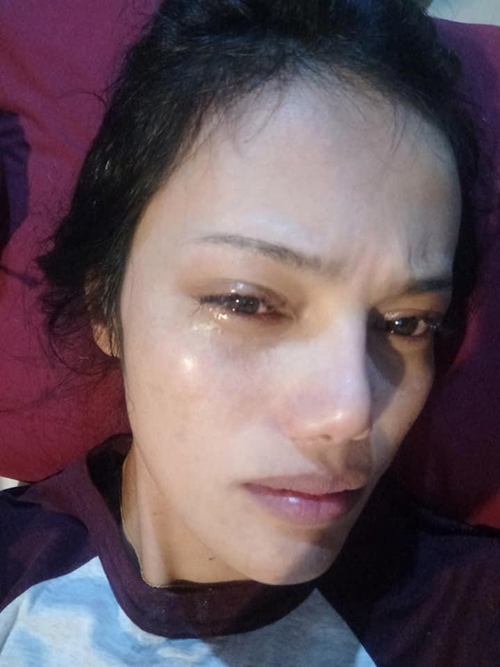 Suýt hỏng mắt vì nối mi bằng keo con voi, keo dán móng - 2