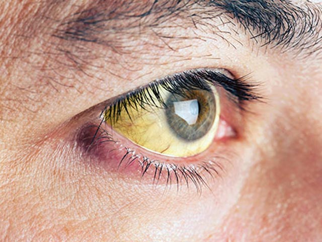 7 tín hiệu ở đôi mắt tưởng thông thường tuy nhiên đã cho chúng ta biết các bạn đang được bắt gặp nguy hại - 2