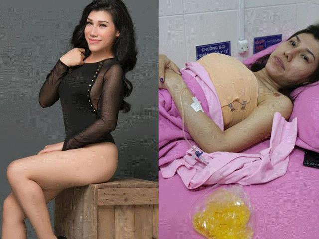 Ca nhạc - MTV - Quách Tuấn Du tiết lộ lý do "thánh nữ" vỡ túi ngực tiếp tục bơm silicon