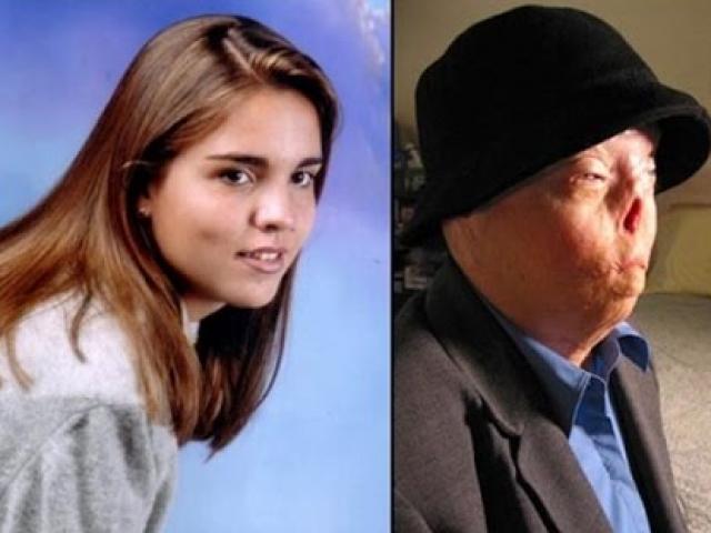 Pháp luật - Khuôn mặt cô gái xinh đẹp biến dạng vì bị tài xế teen đâm trong lúc say