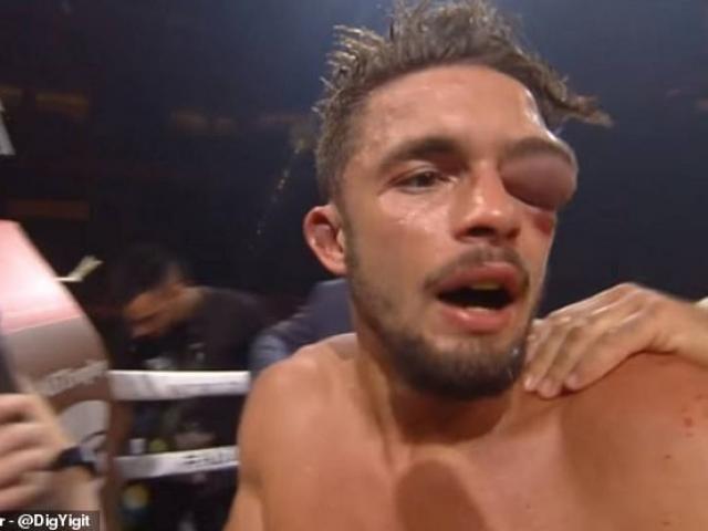 Phát hoảng boxing: Võ sỹ ăn đòn mắt sưng to như trái bóng vẫn quyết tử