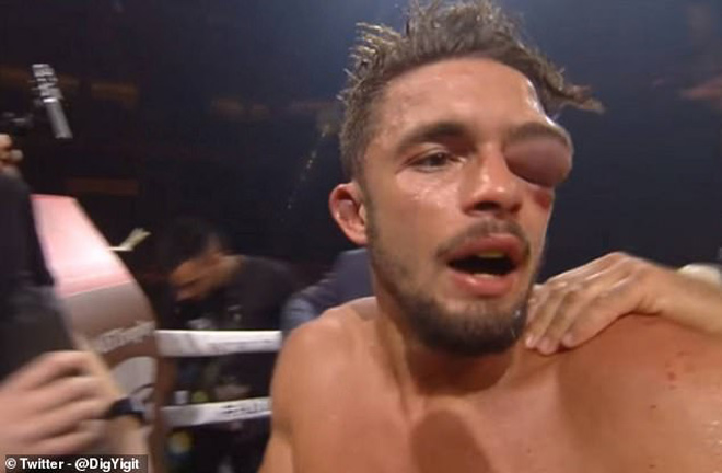 Phát hoảng boxing: Võ sỹ ăn đòn mắt sưng to như trái bóng vẫn quyết tử - 1