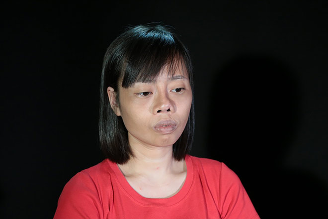 6 tiếng phẫu thuật "Cứu chữa" mũi hỏng cho cô giáo mầm non bị tai nạn - 2