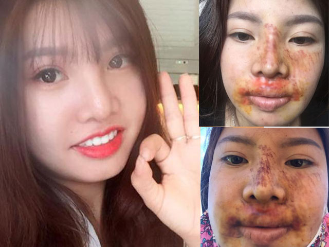 Bạn trẻ - Cuộc sống - Phượng "Thị Nở" khiến dân mạng giật mình bởi nhan sắc hiện tại