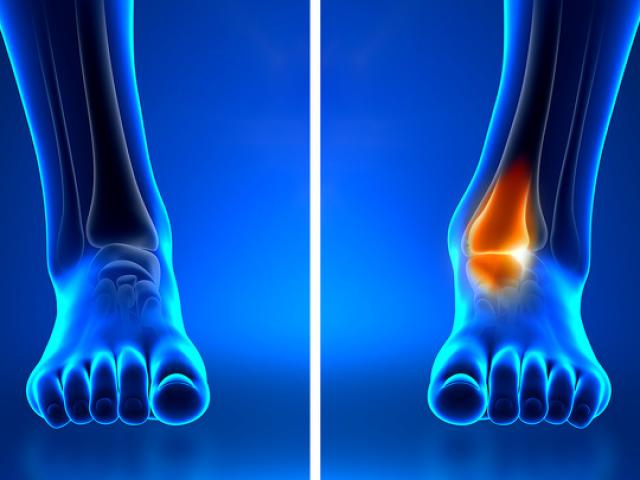 Sức khỏe đời sống - 10 dấu hiệu cơ thể ai cũng nghĩ hoàn toàn bình thường nhưng cảnh báo bệnh nan y