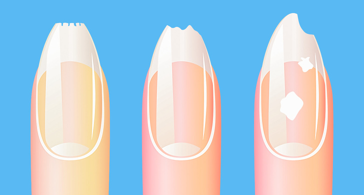 10 dấu hiệu cơ thể ai cũng nghĩ hoàn toàn bình thường nhưng cảnh báo bệnh nan y - 3