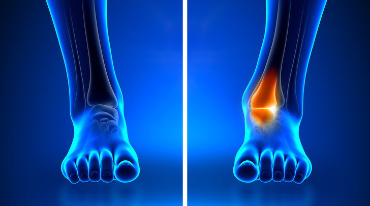 10 dấu hiệu cơ thể ai cũng nghĩ hoàn toàn bình thường nhưng cảnh báo bệnh nan y - 8