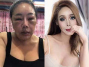 Làm đẹp - Bất ngờ nhan sắc sau dao kéo của nữ đại gia Thái Lan U60