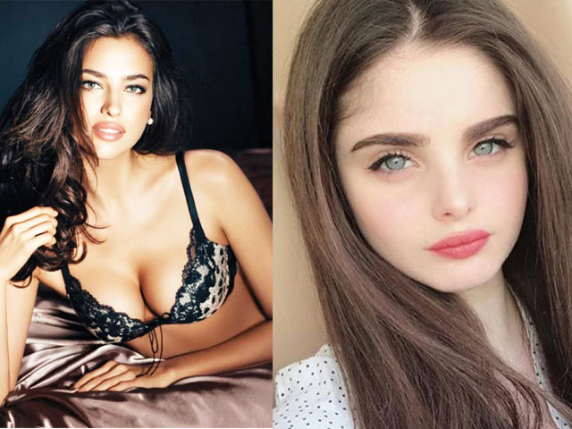 Đôi môi ”thái vội được 2 đĩa” của Irina Shayk là chuẩn mới của gái đẹp Nga