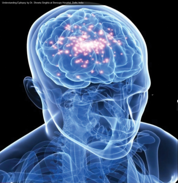 5 căn bệnh nan y bị hiểu lầm tai hại - 6