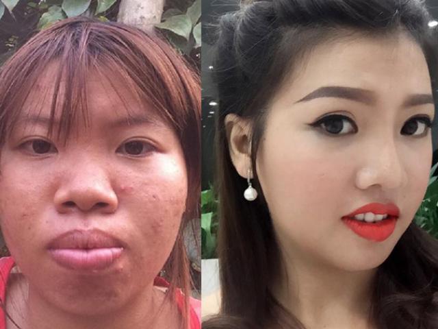 Làm đẹp - 8 ca thẩm mỹ biến "gái xấu thành tiên"