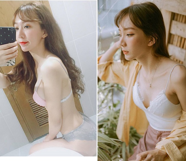 Để có ngoại hình mới: Nhung trải qua 4 lần phẫu thuật. Lần thứ nhất gồm chỉnh hàm hô, gọt hàm, hạ gò má, làm mũi, độn cằm. Lần thứ hai, Nhung được làm lại mũi và lấy mỡ bọng mắt. Lần thứ 3 là hút mỡ đùi để cấy lên mặt. Lần cuối, cô phẫu thuật để lấy chiếc đinh còn xót lại trong miệng. Ngoài ra, cô còn phẫu thuật nâng ngực.&nbsp;