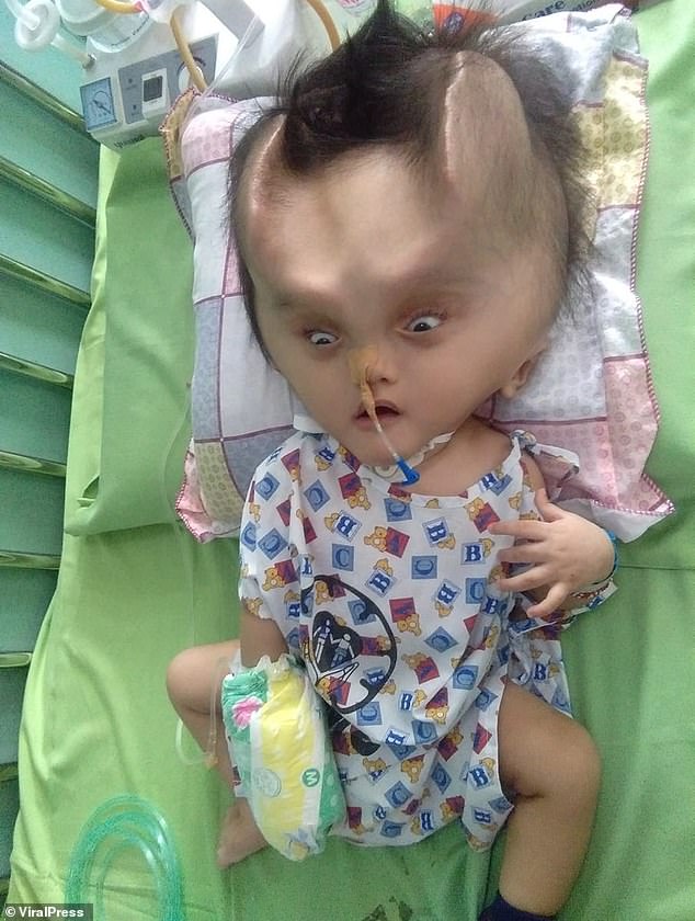 Bé trai mọc “sừng của quỷ” kỳ lạ - 2