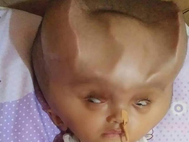 Phi thường - kỳ quặc - Bé trai mọc “sừng của quỷ” kỳ lạ