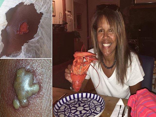 Suýt mất mạng chỉ vì không cẩn thận kiểm tra quần áo trước khi mặc