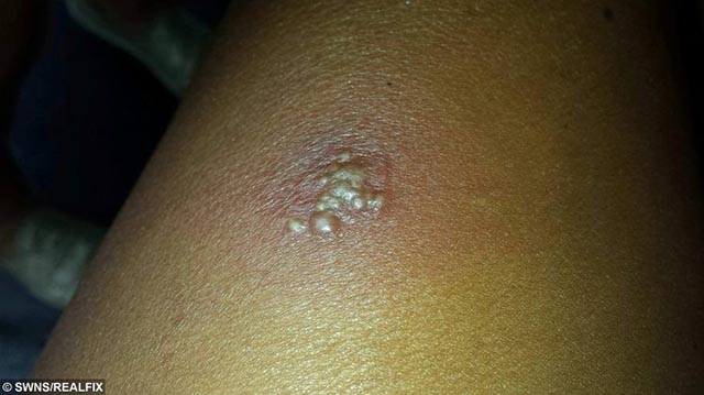 Suýt mất mạng chỉ vì không cẩn thận kiểm tra quần áo trước khi mặc - 2