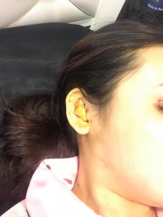 &#34;Hot girl náo loạn phố Nguyễn Huệ&#34; phẫu thuật vì ghét bị gọi là &#34;mặt vuông&#34; - 5