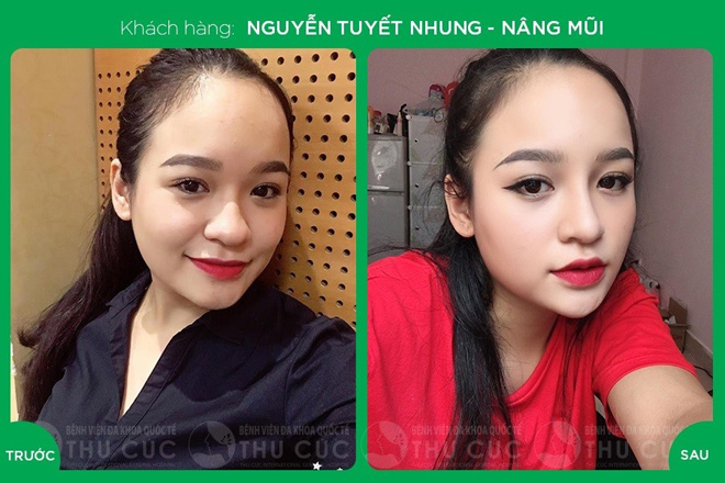 HOT: Bệnh viện đa khoa quốc tế Thu Cúc tặng 40 suất phẫu thuật thẩm mỹ miễn phí - 4