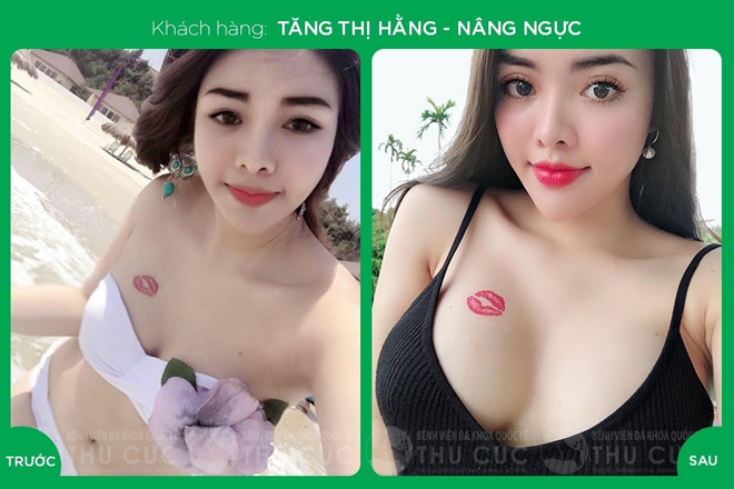 HOT: Bệnh viện đa khoa quốc tế Thu Cúc tặng 40 suất phẫu thuật thẩm mỹ miễn phí - 5