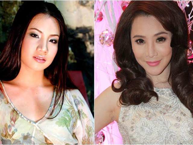 Làm đẹp - Hồ Quỳnh Hương: Nữ hoàng nhạc nhẹ có pha "đập mặt xây lại" sốc nhất?