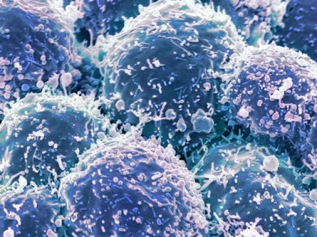 Sức khỏe đời sống - Chế tạo thành công loại virus chuyên diệt tế bào ung thư