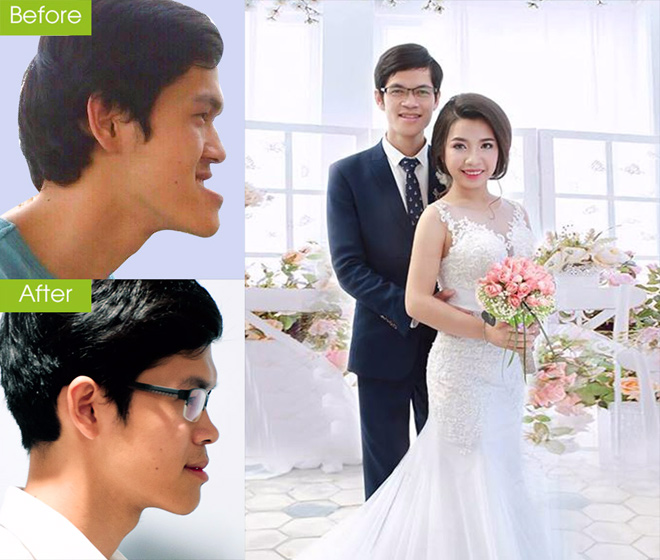 5 thầy cô giáo tự tin theo nghề sau phẫu thuật thẩm mỹ - 1