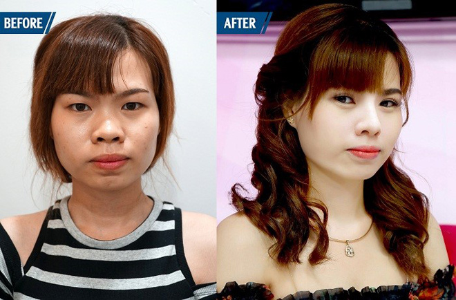 5 thầy cô giáo tự tin theo nghề sau phẫu thuật thẩm mỹ - 6