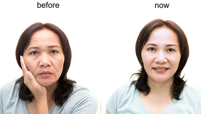 Bệnh viện Thẩm mỹ Ngọc Phú cập nhật nhiều dịch vụ làm đẹp mới đến từ Hàn Quốc - 3