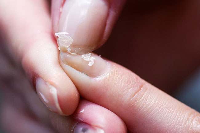 7 dấu hiệu thiếu máu cứ ngỡ không sao, đến lúc phát hiện thì đã quá muộn - 5
