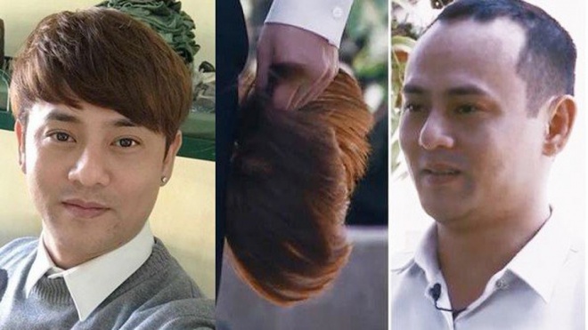 Lộ đầu hói trên sóng quốc gia, Ưng Đại Vệ quyết định cấy 2000 sợi tóc - 3