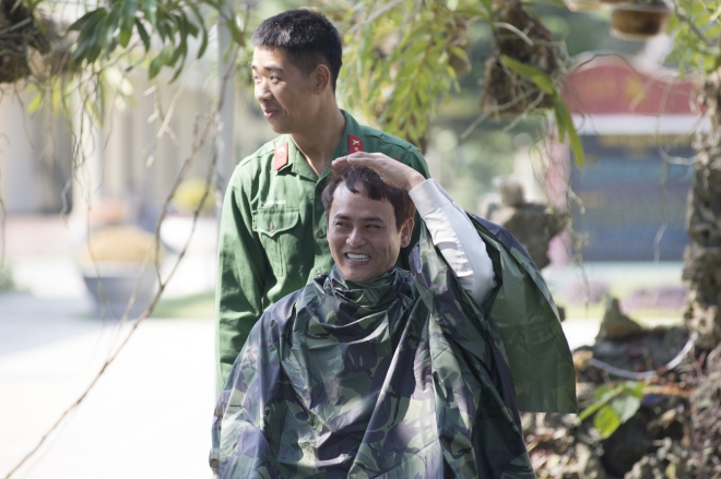 Lộ đầu hói trên sóng quốc gia, Ưng Đại Vệ quyết định cấy 2000 sợi tóc - 2