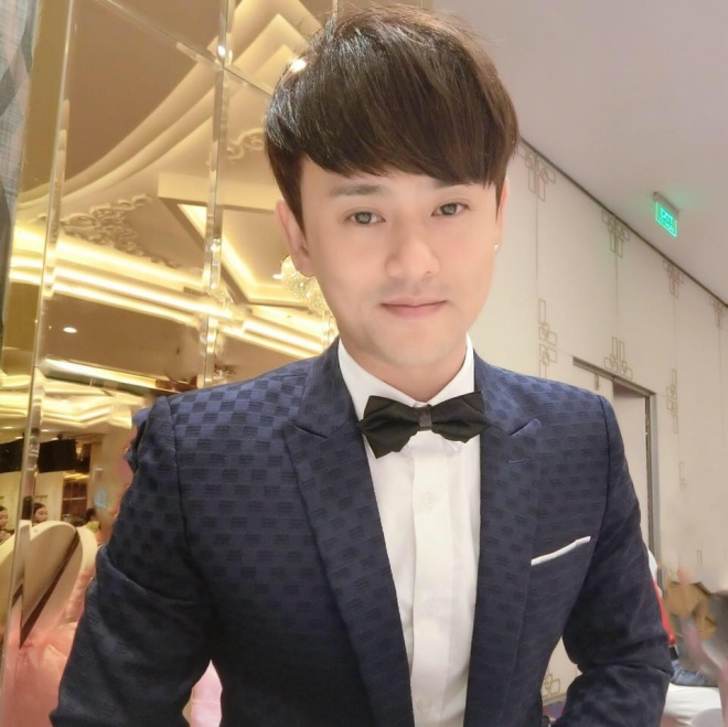 Lộ đầu hói trên sóng quốc gia, Ưng Đại Vệ quyết định cấy 2000 sợi tóc - 1