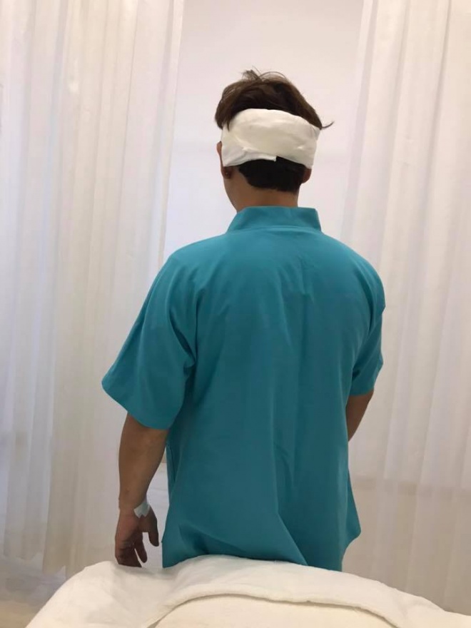 Lộ đầu hói trên sóng quốc gia, Ưng Đại Vệ quyết định cấy 2000 sợi tóc - 7