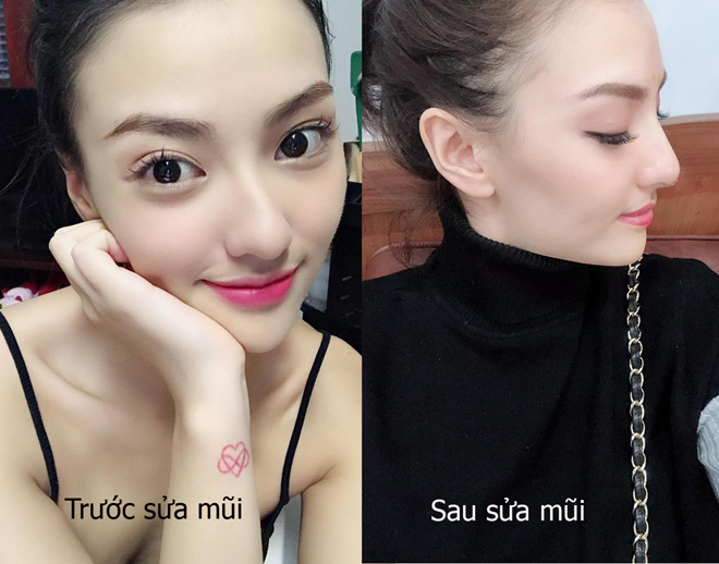 Hồng Quế lần đầu lộ diện sau khi sửa mũi khoằm - 6