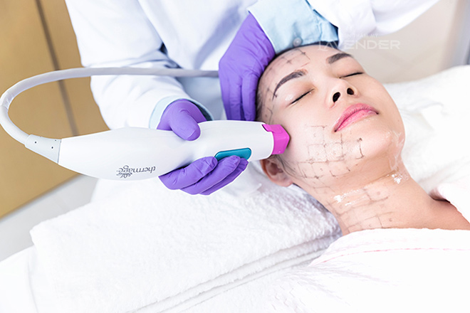 Vừa cập bến Việt Nam, trẻ hóa da Thermage FLX đã tạo nên cơn sốt với phái đẹp - 5