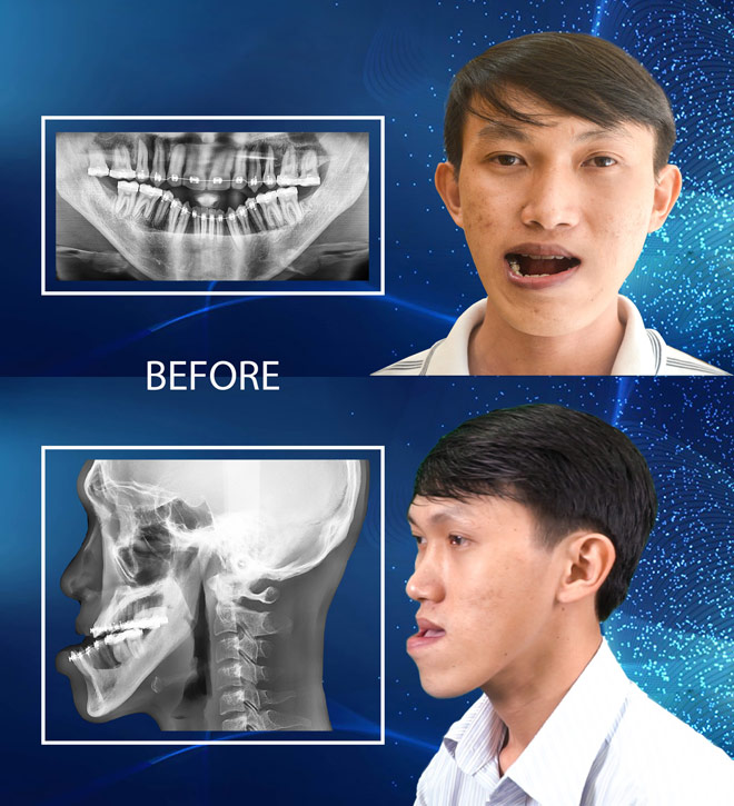 Thạc sĩ xe ôm Duy Phương khiến ca sĩ Phạm Quỳnh Anh “bấn loạn” vì độ soái ca - 3