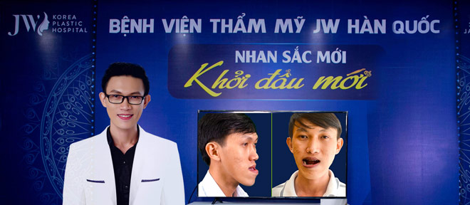 Thạc sĩ xe ôm Duy Phương khiến ca sĩ Phạm Quỳnh Anh “bấn loạn” vì độ soái ca - 2