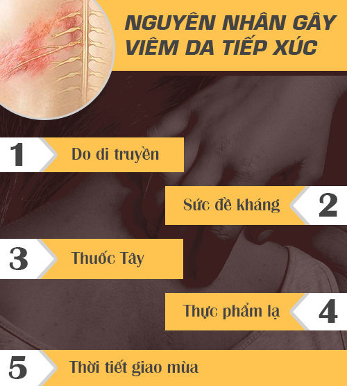 Bệnh viêm da tiếp xúc và cách điều trị hiệu quả từ lời khuyên chuyên gia - 2