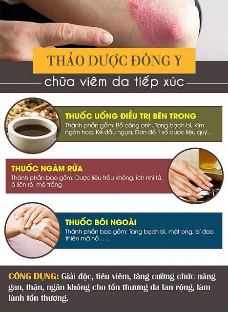 Bệnh viêm da tiếp xúc và cách điều trị hiệu quả từ lời khuyên chuyên gia - 3