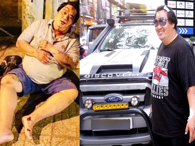 Đời sống Showbiz - Hoàng Mập bị xe đâm, vợ nhanh trí tìm cách cấp cứu khiến người dân vỗ tay