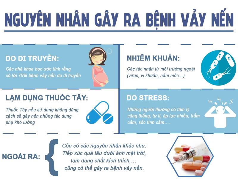 Bệnh vảy nến khổ và khó chịu, điều trị bằng cách nào hữu hiệu nhất? - 2