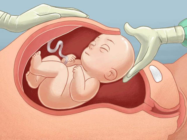 Media - Quá trình sinh mổ diễn ra như thế nào?