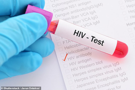 Phát hiện cơ chế giúp chữa khỏi HIV ngay trong não người - 1