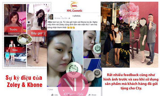 Zoley & Kbone - mỹ phẩm dưỡng da trắng đẹp được phái đẹp Việt tin dùng - 5